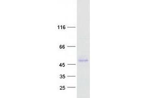 Validation with Western Blot