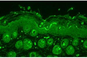 Immunohistochemistry (IHC) image for anti-Ubiquitin (Ub) antibody (APC) (ABIN2481454)