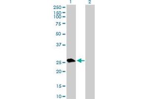 Western Blot analysis of UROS expression in transfected 293T cell line by UROS MaxPab polyclonal antibody. (UROS Antikörper  (AA 1-265))