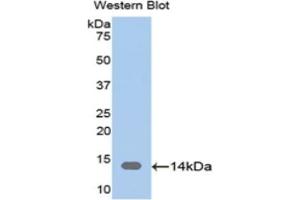 Detection of Recombinant CAP1, Human using Polyclonal Antibody to Adenylyl Cyclase Associated Protein 1 (CAP1) (CAP1 Antikörper  (AA 38-149))