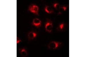 Immunofluorescent analysis of BCL10 staining in A549 cells. (BCL10 Antikörper)
