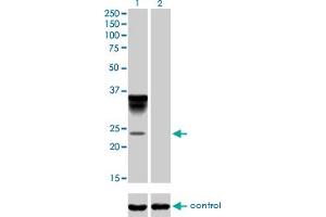 Western blot analysis of ORM1 over-expressed 293 cell line, cotransfected with ORM1 Validated Chimera RNAi (Lane 2) or non-transfected control (Lane 1). (ORM1 Antikörper  (AA 18-201))