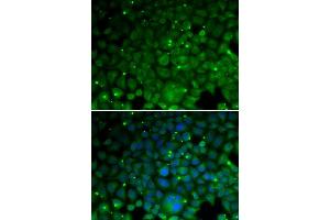 Immunofluorescence analysis of HeLa cells using CRYAA antibody (ABIN5973354).