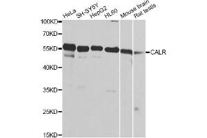 Western blot analysis of extracts of various cell lines, using CALR antibody. (Calreticulin Antikörper)