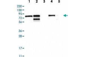 Western blot analysis of Lane 1: RT-4, Lane 2: U-251 MG, Lane 3: Human Plasma, Lane 4: Liver, Lane 5: Tonsil with TMTC2 polyclonal antibody  at 1:250-1:500 dilution. (TMTC2 Antikörper)