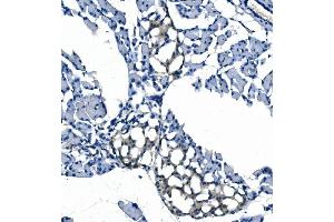 IHC analysis of eRF1/ETF1 using anti-eRF1/ETF1 antibody (ABIN7602626). (ETF1 Antikörper  (AA 9-342))