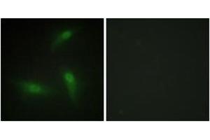 Immunofluorescence analysis of HeLa cells, using hnRNP A1 Antibody. (HNRNPA1 Antikörper  (AA 51-100))