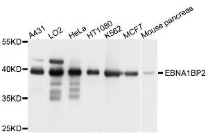 Western blot analysis of extracts of various cell lines, using EBNA1BP2 antibody. (EBNA1BP2 Antikörper  (AA 1-306))