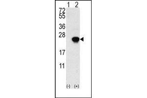 Western blot analysis of FGF1 (arrow) using rabbit polyclonal FGF1 Antibody (FGF1 Antikörper  (N-Term))