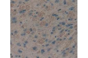 Immunohistochemistry (IHC) image for anti-Insulin Receptor (INSR) (AA 1114-1382) antibody (ABIN1859481)
