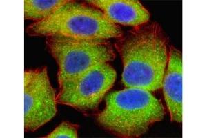 Fluorescent confocal image of U251 cell stained with RELA antibody at 1:25.