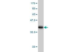 Western Blot detection against Immunogen (35. (AKT3 Antikörper  (AA 100-189))