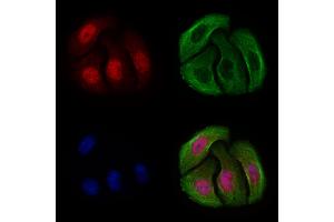ABIN6256592 and ABIN6267253 staining Hela cells(4h of LPS treatment) by IF/ICC. (CHEK2 Antikörper  (pThr68))