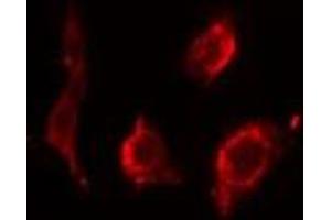 ABIN6275545 staining HeLa cells by IF/ICC. (PPP2R2B Antikörper  (Internal Region))