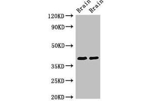 Western Blot Positive WB detected in: Rat brain tissue, Mouse brain tissue All lanes: STOML3 antibody at 3. (STOML3 Antikörper  (AA 205-291))