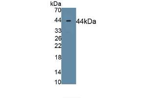 Detection of Recombinant MYH11, Rat using Polyclonal Antibody to Myosin Heavy Chain 11, Smooth Muscle (MYH11) (MYH11 Antikörper  (AA 1-351))