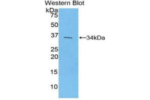 Western Blotting (WB) image for anti-Interferon Regulatory Factor 4 (IRF4) (AA 175-433) antibody (ABIN3206122) (IRF4 Antikörper  (AA 175-433))