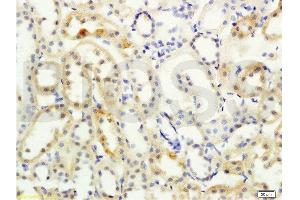 Formalin-fixed and paraffin embedded rat kidney labeled with Anti- NCX2/SLC8A2 Polyclonal Antibody, Unconjugated  at 1:200 followed by conjugation to the secondary antibody and DAB staining (SLC8A2 Antikörper  (AA 601-700))