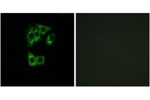 Immunofluorescence analysis of A549 cells, using GIMAP2 Antibody. (GIMAP2 Antikörper  (AA 201-250))
