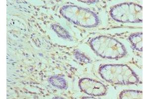 Immunohistochemistry of paraffin-embedded human colon tissue using ABIN7144372 at dilution of 1:100