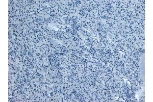 Immunohistochemistry (IHC) image for anti-Ionized Calcium-binding Adapter Molecule 1 (IBA1) (C-Term) antibody (ABIN184738)