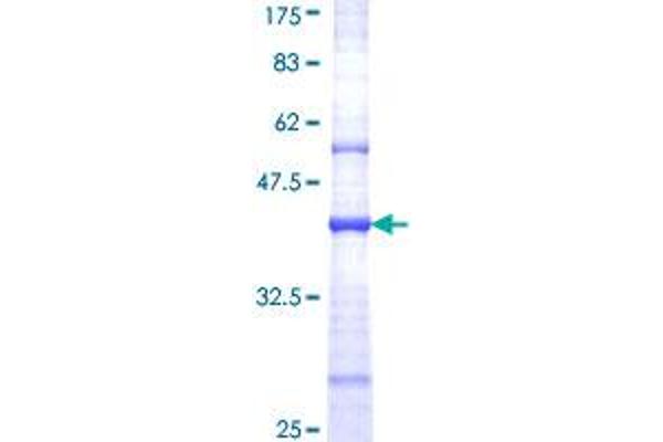 GRIN2B Protein (AA 127-236) (GST tag)