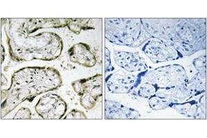 Immunohistochemistry analysis of paraffin-embedded human placenta, using MRPS32 Antibody.
