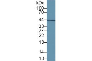 Detection of vWA1 in Rat Kidney lysate using Polyclonal Antibody to Von Willebrand Factor A Domain Containing Protein 1 (vWA1) (VWA1 Antikörper  (AA 43-285))