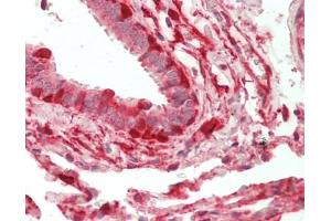 Human Lung, Respiratory Epithelium: Formalin-Fixed, Paraffin-Embedded (FFPE). (ADH7 Antikörper  (HRP))