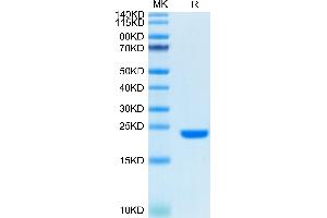 Biotinylated Human FGF10 on Tris-Bis PAGE under reduced condition. (FGF10 Protein (AA 38-208) (Biotin))