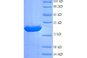 SDS-PAGE (SDS) image for Agouti Related Protein Homolog (Mouse) (AGRP) (AA 21-132) protein (His-SUMO Tag) (ABIN5709009) (AGRP Protein (AA 21-132) (His-SUMO Tag))