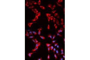 Immunofluorescence analysis of U2OS cells using EIF4B antibody. (EIF4B Antikörper)