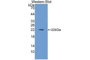 Western blot analysis of the recombinant protein. (IL1A Antikörper)