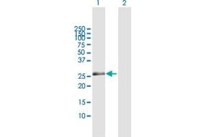 Western Blot analysis of ZNF266 expression in transfected 293T cell line by ZNF266 MaxPab polyclonal antibody. (ZNF266 Antikörper  (AA 1-263))