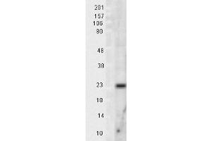 Mn SOD Rat tissue lysate 10ug Western Blotting 1 in 1000 copy. (SOD2 Antikörper)