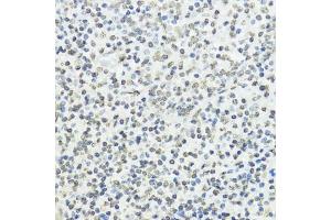 Immunohistochemistry of paraffin-embedded human tonsil using Phospho-Histone H3-T45 antibody (ABIN7267692) at dilution of 1:100 (40x lens).