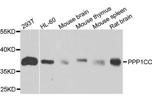 Western blot analysis of extracts of various cells, using PPP1CC antibody. (PPP1CC Antikörper)