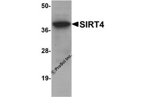 Western Blotting (WB) image for anti-Sirtuin 4 (SIRT4) (N-Term) antibody (ABIN1031569)