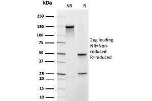 SDS-PAGE Analysis Purified Frataxin Recombinant Mouse Monoclonal Antibody (rFXN/2124). (Rekombinanter Frataxin Antikörper  (AA 57-210))
