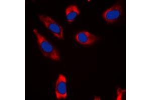 Immunofluorescent analysis of STMN1 staining in HeLa cells. (Stathmin 1 Antikörper  (N-Term))
