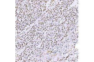 IHC analysis of STAG2 using anti-STAG2 antibody (ABIN7602420).