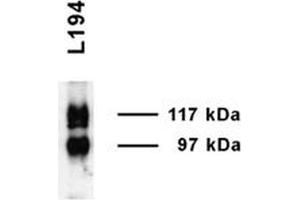 Western blot analysis of Rat Inner medulla showing detection of UT-A1 protein using Rabbit Anti-UT-A1 Polyclonal Antibody . (Solute Carrier Family 14 (Urea Transporter, Kidney) Member 2 (SLC14A2) (AA 911-929) Antikörper (Atto 488))