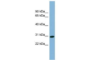 CENPQ Antikörper  (N-Term)