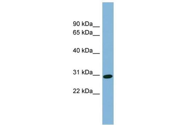 CENPQ antibody  (N-Term)