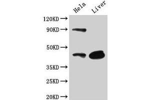 Western Blot Positive WB detected in: Hela whole cell lysate, Mouse liver tissue All lanes: CD46 antibody at 3 μg/mL Secondary Goat polyclonal to rabbit IgG at 1/50000 dilution Predicted band size: 44, 45, 43, 41, 42, 40, 37 kDa Observed band size: 44 kDa (CD46 Antikörper  (AA 164-325))