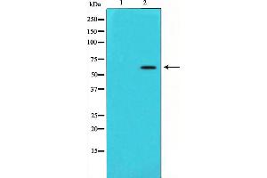 Western blot analysis of Angiopoietin 1 expression in HeLa cells,The lane on the left is treated with the antigen-specific peptide. (Angiopoietin 1 Antikörper  (Internal Region))