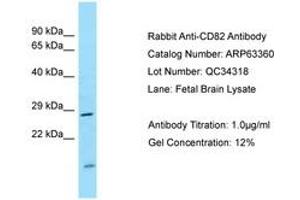 Image no. 1 for anti-CD82 (CD82) (AA 98-147) antibody (ABIN6749974) (CD82 Antikörper  (AA 98-147))