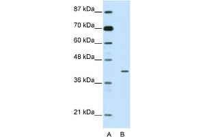 WB Suggested Anti-HMBOX1 Antibody Titration:  2.