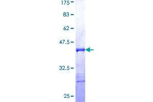 RIPK2 Protein (AA 431-540) (GST tag)