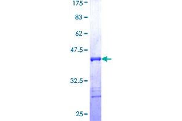 RIPK2 Protein (AA 431-540) (GST tag)